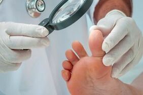 Behandlung von Plantarfärken