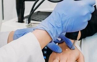 Möglichkeiten, Warzen zu entfernen