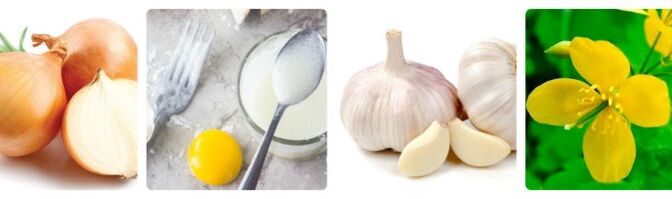 Rezepte für Volksheilmittel gegen Warzen